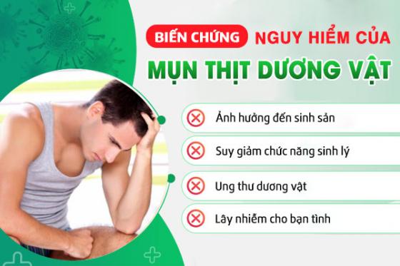 mun-thit-duong-vat.jpg